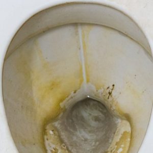 Tips For Splash Toilet Bowl Cleaner